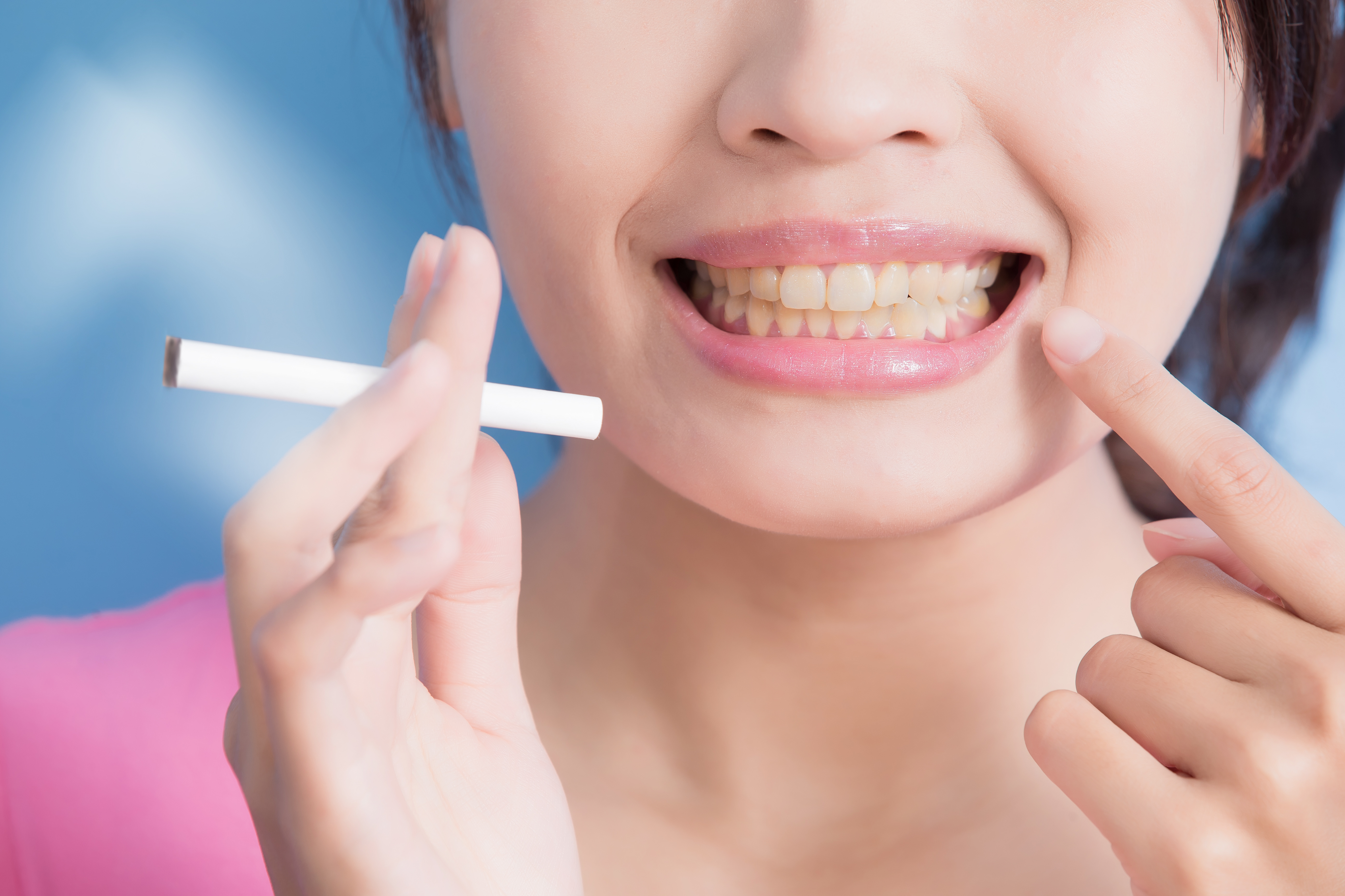 Я курильщик: есть ли смысл в отбеливании зубов?