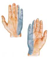 Что вызывает онемение пальцев рук